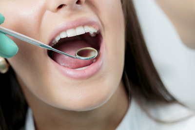 Tooth Extraction